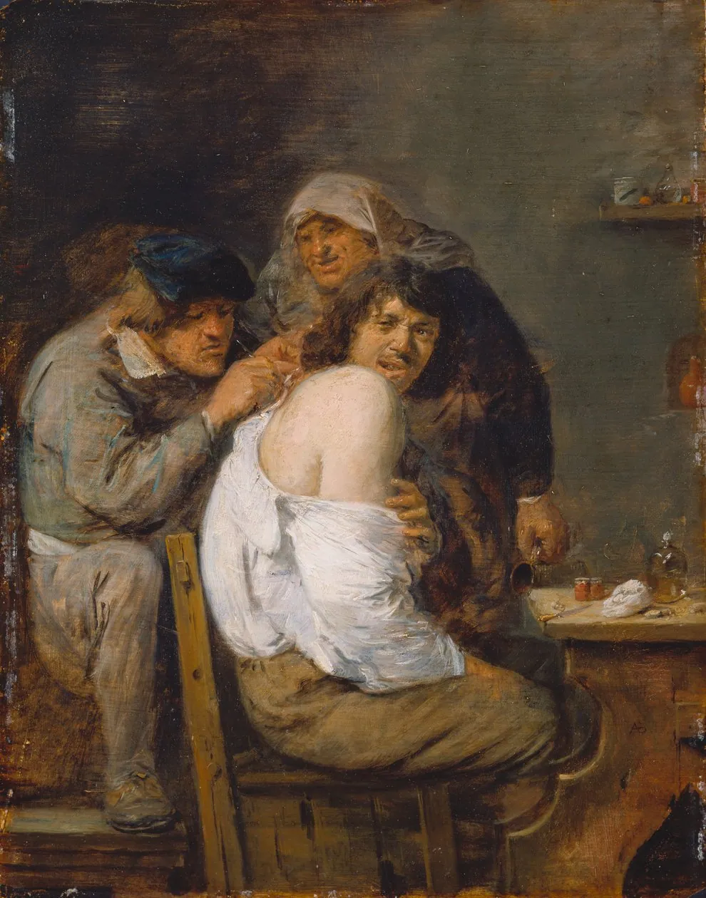La operación de espalda, de Adriaen Brouwer
