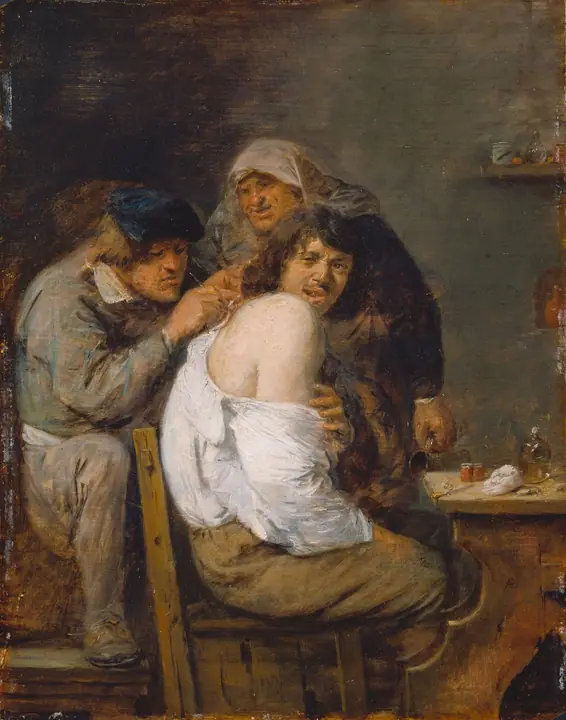 La operación de espalda, Adriaen Brouwer